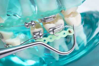 Close-up of artificial teeth