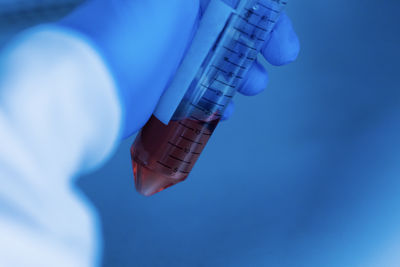 Cropped hand of scientist examining x-ray