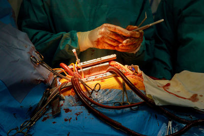Midsection of surgeon operating patient in hospital