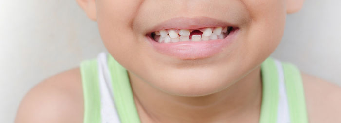 Close-up of boy with broken tooth