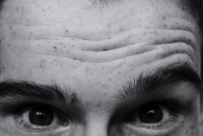 Cropped portrait of man with freckles on forehead