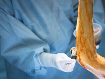 Midsection of surgeon applying medicine on patient arm in hospital