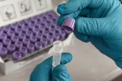 Hand of scientist in blue gloves with blood test tube. medical laboratory testing, analysis 