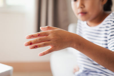 Fresh wound and blood from injured on child fingers after she has been an accident.