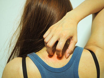 Rear view of woman scratching back