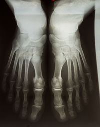 Low section of human feet