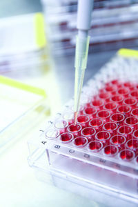 High angle view of medical samples and test tube rack