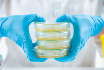 Microbiology. hands of a microbiology lab technician holding a stack with petri dishes containing 