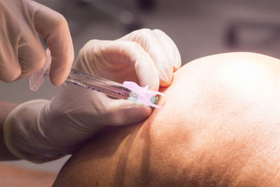 Close-up of doctor injecting patient on knee