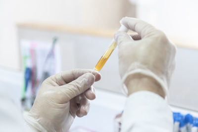 Cropped hand of doctor holding dentures