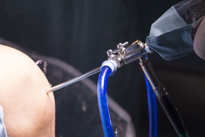 Cropped image of doctor operating patient in hospital