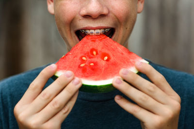 Teen boy with braces bites into watermelon