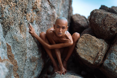Young bald girl on the beach