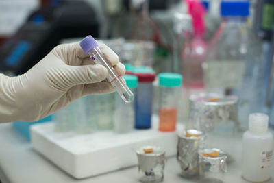 Cropped hands testing chemicals in laboratory