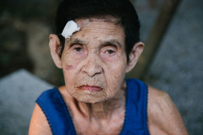 Woman with injured forehead outdoors