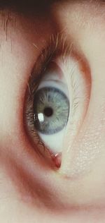 eye