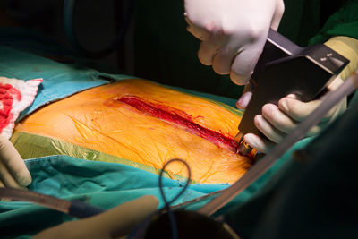 Doctors performing surgery on patient in operating room