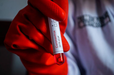 Close-up of hand holding blood test sample 