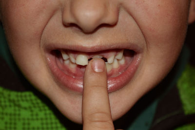 Close-up of boy touching gap toothed