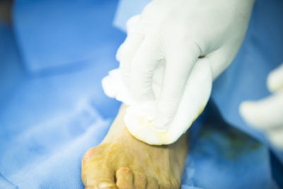 Close-up of surgeon cleaning patient foot
