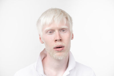 Portrait of young man with albino against white background