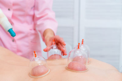 Woman is receiving canning treatment at spa. cupping therapy. treatment used