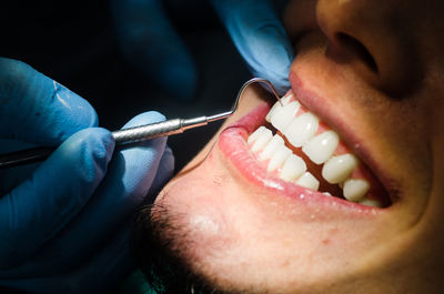 Cropped hand doctor examining patient teeth at clinic