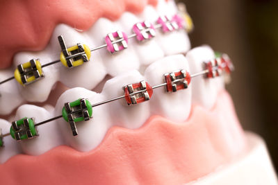 Close-up of dental equipment