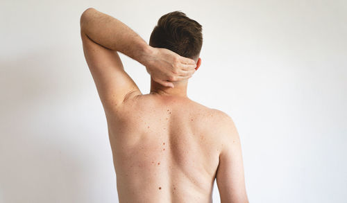 Pigmentation. close up detail of the bare skin on a man back with scattered moles and freckles.