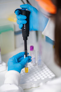 Lab technician pipetting a sample