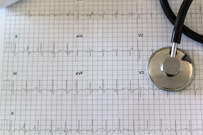 Close-up of stethoscope on pulse trace