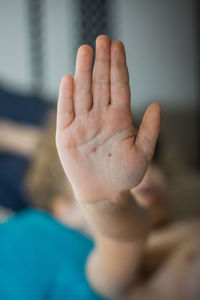 Hand of boy with chickenpox 