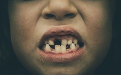 Midsection of girl with gap tooth against black background