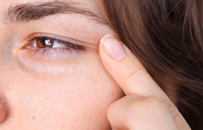 Woman with brown eyes and hair close up. vision problems, astigmatism.