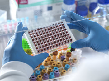 Male scientist holding blood samples in multi well plate at laboratory