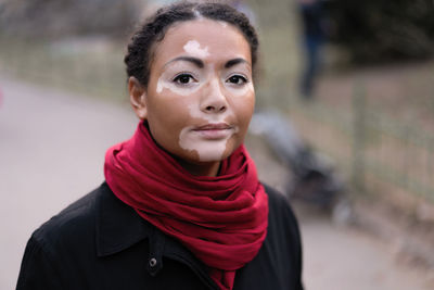 Portrait of young woman with vitiligo standing on road in city