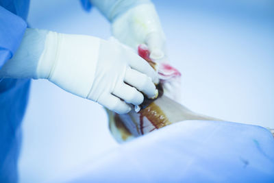 Close-up of surgeon cleaning patient wounded foot in operating room