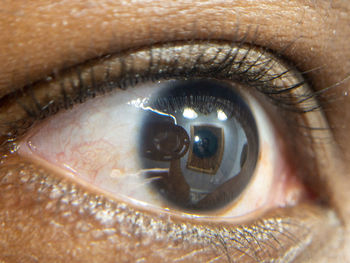 Close up of african american mans dark brown eyes for use in ophthalmology optometry imagery