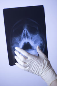 Cropped hand of person pointing at x-ray image on table