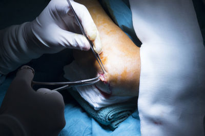 Cropped hands of surgeons doing knee surgery in hospital