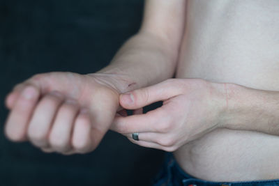 Midsection of shirtless mid adult man with wounded hand against black background