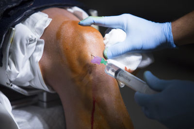 Close-up of doctor injecting syringe in patient knee in operating room
