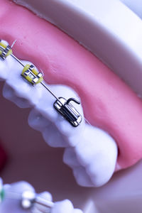 Close-up of braces on teeth