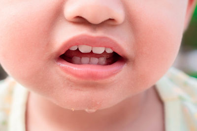 Mouth and milk teeth of a 2-year-old child