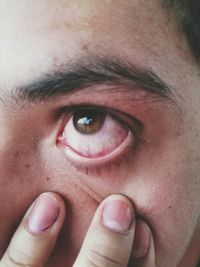 Cropped image of person touching eye