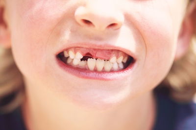 Close-up of gap toothed boy