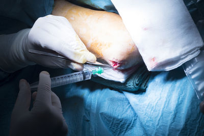 Cropped hands of doctor stitching elbow of patient