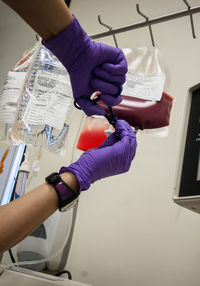 Cropped hands of nurse cutting blood bag using scissors