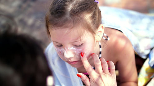 Girls, severe sunburn on the face. mom smears places of burns abundantly with a special cream. 