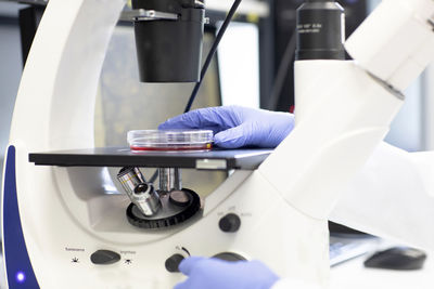 Scientist with petri dish examining medical sample through microscope